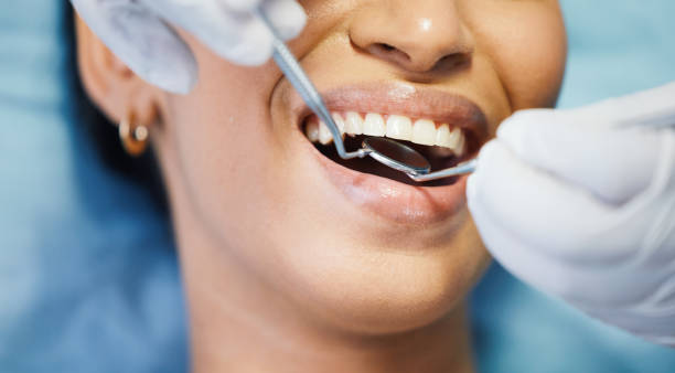Best Chipped Tooth Repair Near Me  in Sierra Ridge, CO
